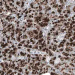 Merck ANTI-DHRSX antibody produced in rabbit