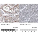 Merck Anti-CEP192 antibody produced in rabbit