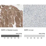 Merck Anti-DMPK antibody produced in rabbit