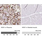 Merck Anti-KISS1 antibody produced in rabbit