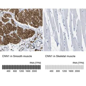 Merck Anti-CNN1 antibody produced in rabbit