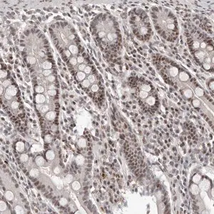 Merck Anti-ATF5 antibody produced in rabbit