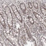 Merck Anti-ATF5 antibody produced in rabbit