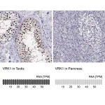 Merck Anti-VRK1 antibody produced in rabbit