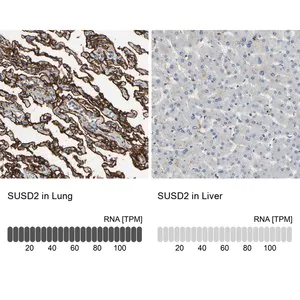 Merck Anti-SUSD2 antibody produced in rabbit