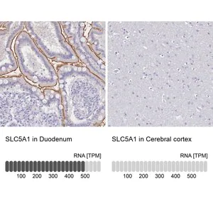 Merck Anti-SLC5A1 antibody produced in rabbit