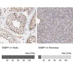 Merck Anti-SSBP1 antibody produced in rabbit