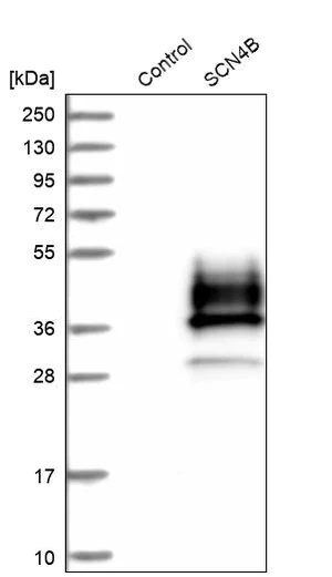 Merck Anti-SCN4B antibody produced in rabbit