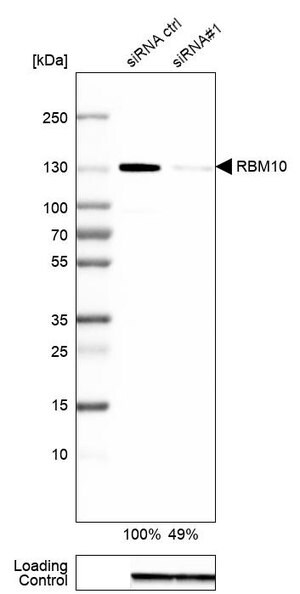 Merck Anti-RBM10 antibody produced in rabbit