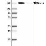Merck Anti-RBM10 antibody produced in rabbit