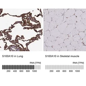 Merck Anti-S100A10 antibody produced in rabbit