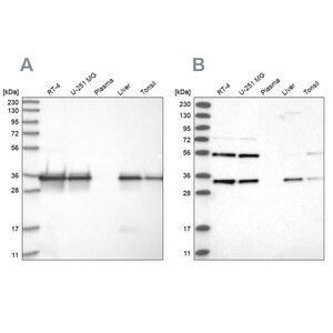 Merck Anti-PPA2 antibody produced in rabbit