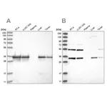 Merck Anti-PPA2 antibody produced in rabbit