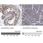 Merck Anti-CALCOCO2 antibody produced in rabbit