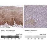 Merck Anti-WNK1 antibody produced in rabbit