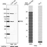 Merck Anti-p53 antibody produced in rabbit