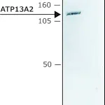 Merck Anti-ATP13A2 (C-terminal) antibody produced in rabbit