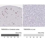 Merck Anti-TMEM35A antibody produced in rabbit