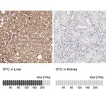 Merck Anti-OTC antibody produced in rabbit