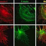 Merck Anti-FSCN1 antibody produced in rabbit