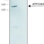 Merck Anti-ATP13A2 antibody produced in rabbit
