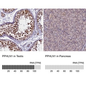 Merck Anti-PPHLN1 antibody produced in rabbit