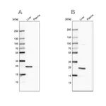 Merck Anti-CRP antibody produced in rabbit