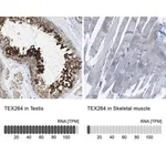 Merck Anti-TEX264 antibody produced in rabbit
