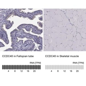 Merck Anti-CCDC40 antibody produced in rabbit