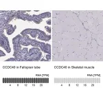 Merck Anti-CCDC40 antibody produced in rabbit