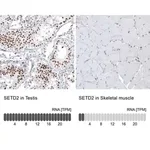 Merck Monoclonal Anti-SETD2 antibody produced in mouse