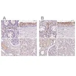 Merck Anti-HEXB antibody produced in rabbit