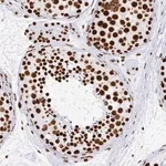 Merck Anti-EWSR1 antibody produced in rabbit
