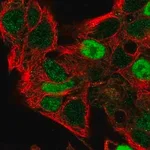 Merck Anti-CCND2 antibody produced in rabbit
