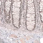 Merck Anti-FOXM1 antibody produced in rabbit