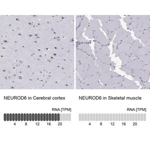 Merck Anti-NEUROD6