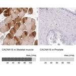 Merck Anti-CACNA1S antibody produced in rabbit