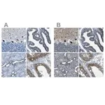 Merck Anti-STIM1 antibody produced in rabbit