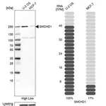 Merck Anti-SMCHD1 antibody produced in rabbit
