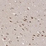 Merck Anti-VPS37A antibody produced in rabbit