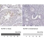 Merck Anti-NUTM1 antibody produced in rabbit