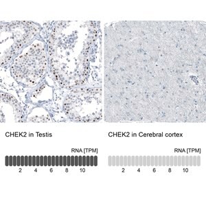 Merck Monoclonal Anti-CHEK2 antibody produced in mouse