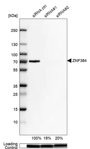 Merck Anti-ZNF384 antibody produced in rabbit