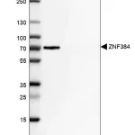 Merck Anti-ZNF384 antibody produced in rabbit