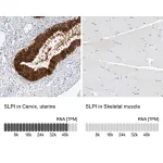 Merck Anti-SLPI antibody produced in rabbit