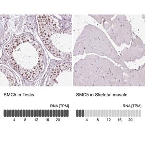 Merck Anti-SMC5 antibody produced in rabbit