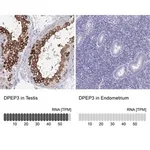 Merck Anti-DPEP3 antibody produced in rabbit