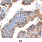 Merck Anti-AGR2 antibody produced in rabbit