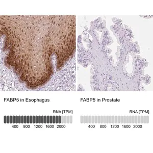 Merck Anti-FABP5 antibody produced in rabbit
