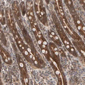 Merck Anti-ABHD11 antibody produced in rabbit